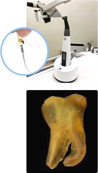 マイクロスコープ