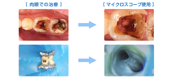 マイクロスコープ使用